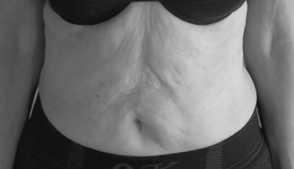 Before BAUD Liftwear — case 1, Age 72
